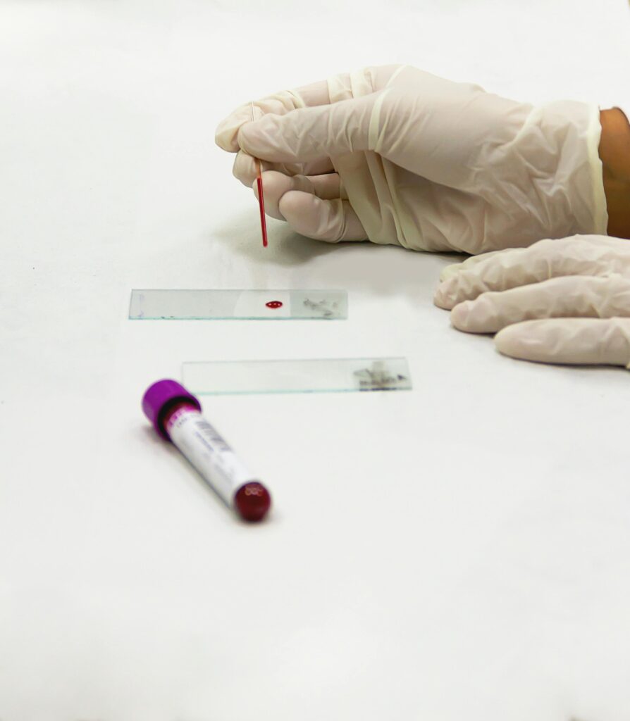 A lab technician in gloves preparing a blood sample with a microscope slide in a laboratory setting.